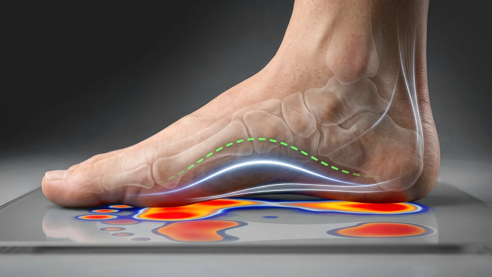 Pressure map under a foot showing load as a colour scale