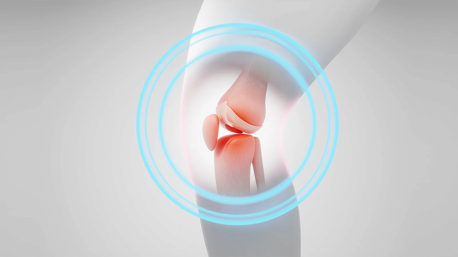 Knee joint ringed by concentric blue arcs