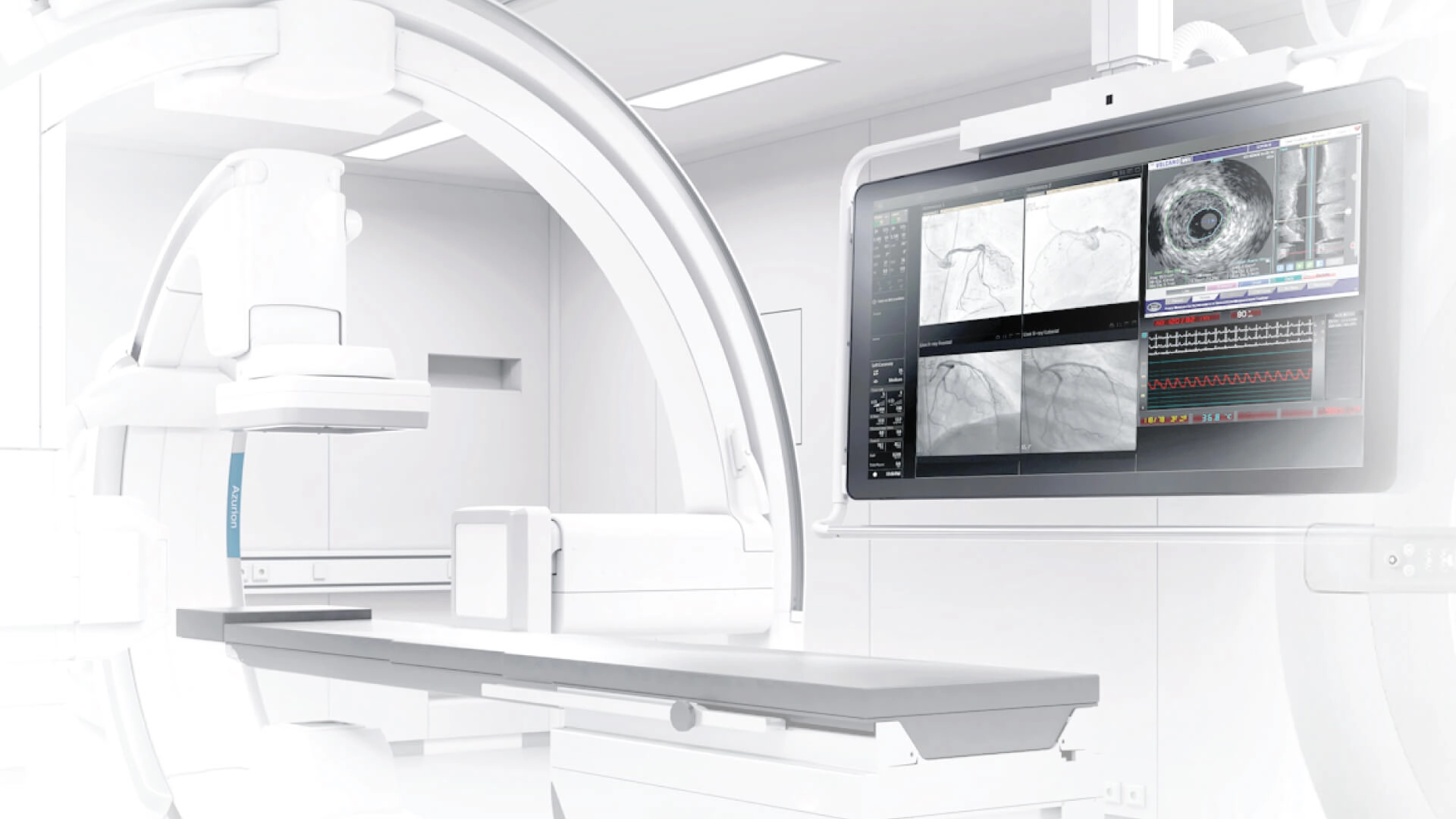 จี้ก้อนไทรอยด์ด้วยคลื่นความถี่วิทยุ (Thyroid Ablation / RFA)